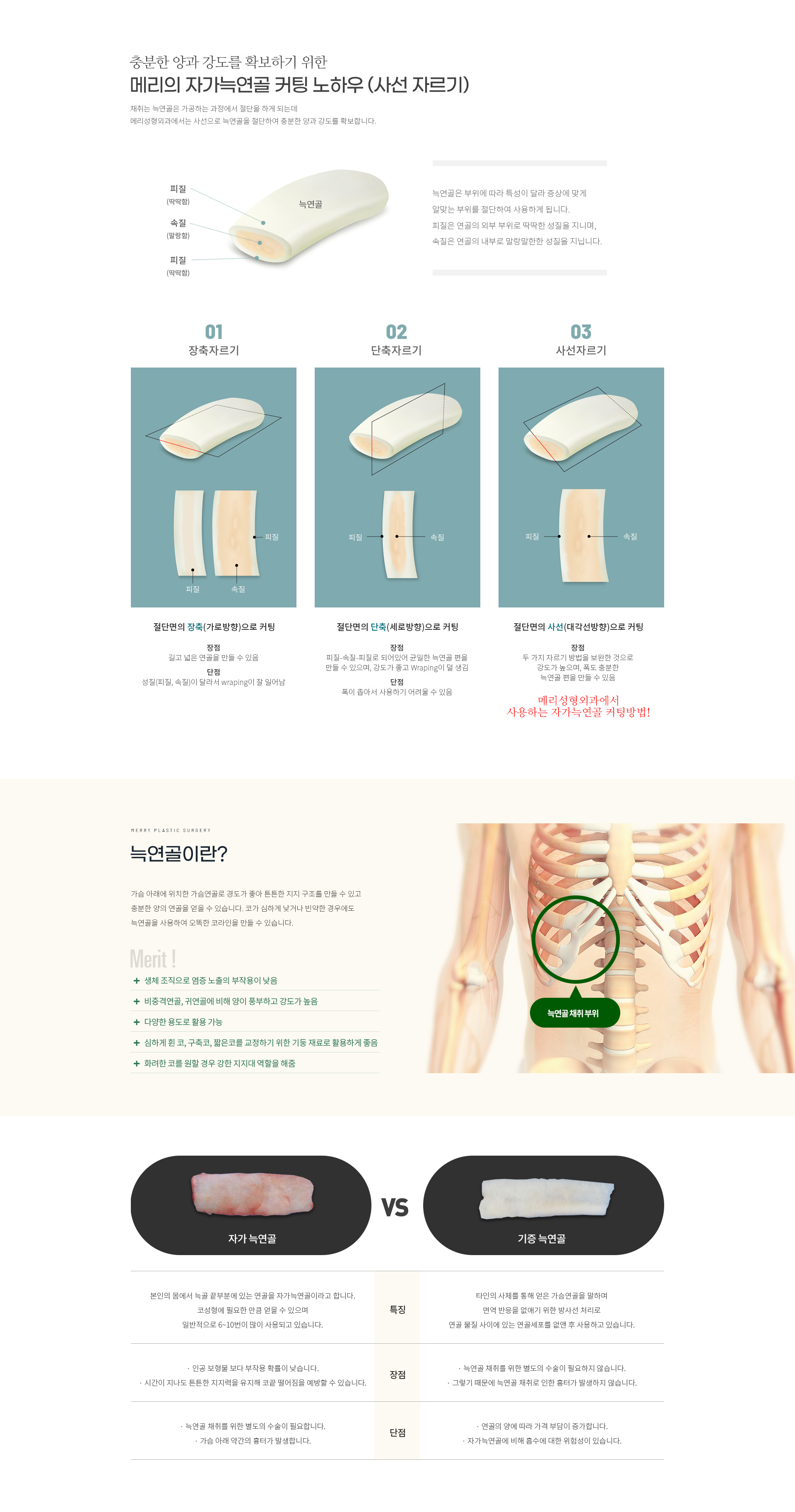 늑연골